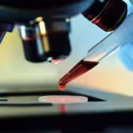 Avance contra la Leucemia: un simple análisis de sangre podría reemplazar la biopsia de médula